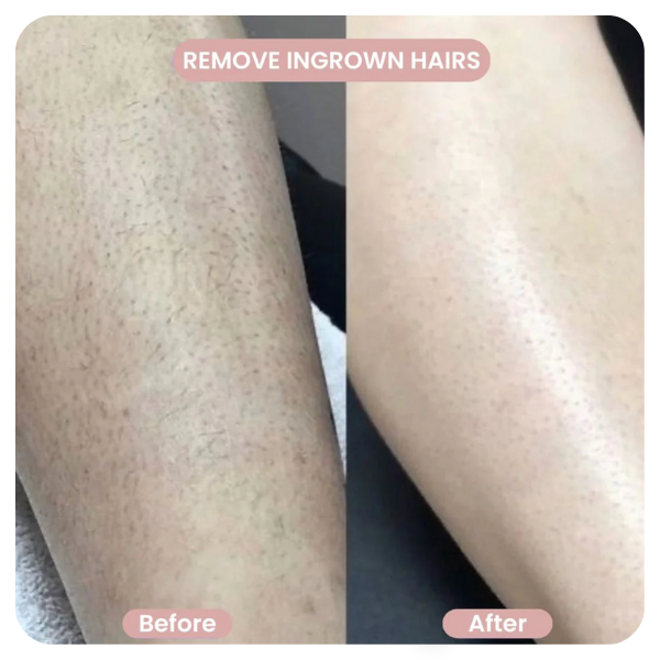 GlowShave™ – 2-in-1 Women’s Body Shaver